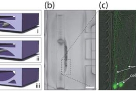 Figure illustrates "lab on a chip" technique developed by MIT researchers to allow immobilization and imaging of a live C. elegans worm: (a-i) worm moves freely in chip's microfluidic channel; (a-ii) partial immobilization of worm; (a-iii) full immobilization; (b) low magnification image of worm immobilized in the device; (c) close-up of immobilized worm showing animal's neurons (fluorescent).