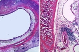 Cross-section and close-up of a rabbit trachea whose inner lining has been damaged. The injuries here were treated by adding engineered tracheal cells.