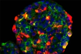 Human mammary epithelial cells that undergo an epithelial-to-mesenchymal transition (EMT) in culture may grow in suspension into structures called mammospheres--a trait they share with mammary epithelial stem cells. Here, the yellow cells present surface proteins indicating that they can develop into more than one type of mammary cell.
