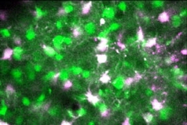 A field of neurons (green) and astrocytes(purple) within visual cortex, visualized by high-resolution two-photon imaging in the intact brain. The astrocytesare labeled with the marker dye SR101, and both neurons and astrocytesare subsequently labeled with the calcium indicator OGB1.