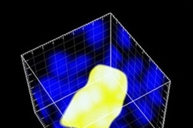 MIT engineers used a new imaging technique to pinpoint the locations of mouse pancreatic cells with a specific mutation. The blue dots represent pancreatic cell nuclei, and the cells within the yellow cluster express the mutation.