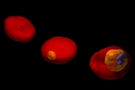 3D images of a human red blood cell (RBC) invaded by malaria-inducing parasite Plasmodium falciparum, at different stages of parasite development. The images are based on 3D maps of the refractive index in the cell, recorded by the non-invasive optical technique of Tomographic Phase Microscopy. Healthy RBC exhibits a characteristic biconcave shape (left). During the early stage of parasite maturat...