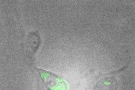 This image shows the cell after hydrogen peroxide is added. The change in fluorescence provides a "fingerprint" that allows different molecules to be identified.