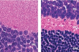 MIT researchers found that mice with normal DNA repair systems had more retinal degeneration upon exposure to environmental toxic agents than mice lacking a certain DNA repair system.  At right, the cross section of the retina from a mouse lacking the repair system is normal. At left, mice with too much DNA repair have greatly reduced numbers of cells in the OPL (outer plexiform layer) and ONL (ou...