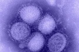 An image of the H1N1 influenza virus taken in the CDC Influenza Laboratory.