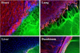 Images showing the interface between a surgical glue (green) and tissue samples (red, blue and black) from the heart, lung, liver, and duodenum. The glue works best with duodenum tissue (note smooth interface), and worst with lung tissue (pockmarked with holes).