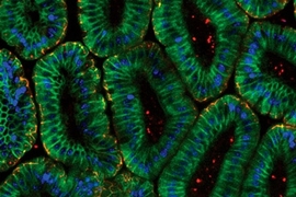 Shown here are mouse intestinal epithelial cells. MIT and MGH researchers have modeled how such cells respond to tumor necrosis factor
