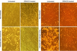 The microscope images above show that DRACO successfully treats viral infections. In this set of four photos, dengue hemorrhagic fever virus kills untreated monkey cells (lower left), whereas DRACO has no toxicity in uninfected cells (upper right) and cures an infected cell population (lower right).