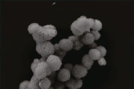A cluster of microsponges made of long strands of folded RNA, as seen by scanning electron microscopy.