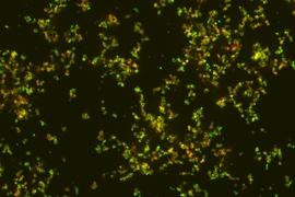 Nanoparticles, in green, targeting bacteria, shown in red.