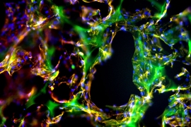 This image shows endothelial cells on three-dimensional scaffolds: the scaffold is in green, the cells in red and the nucleus in blue.