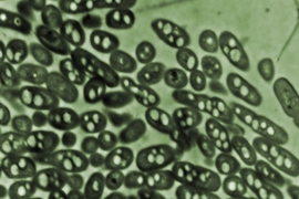 Micrograph shows a group of <i>Ralstonia eutropha</i> bacteria in culture. In their natural form, as seen here, the microbes convert carbon in their surrounding into a kind of bioplastic — seen as the light-colored dots inside their membranes. But a biologically engineered version developed at MIT instead produces isobutanol fuel, which is then expelled from the cells into the surrounding medium...