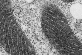 In this electron microscope image of a mitochondrion, the matrix has been stained with APEX, making it appear dark. The lighter projections into the matrix represent the intermembrane space.