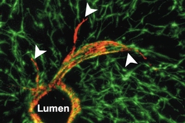 Researchers at MIT and the University of Pennsylvania successfully grew blood vessels within liver tissue grown in the lab. The red circle is a cross-section of the vessel, and endothelial cells (red) sprout from the surface of the tube.