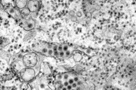 This transmission electron micrograph depicts a number of round, dengue virus particles that were revealed in a tissue specimen.