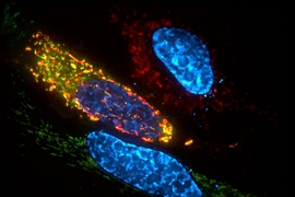 To determine the location of ALKBH7 in cells, MIT researchers engineered these cells to express ALKBH7 bound to green fluorescent protein (GFP). The cells’ mitochondria express a red fluorescent protein. In cells where ALKBH7 is present in the mitochondria, the green and red signals mix and appear yellow.