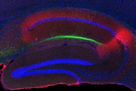 This cross-section of the hippocampus shows island cells (green) projecting to the CA1 region of the hippocampus.