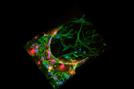 A three-dimensional reconstruction of a confocal image for a bone-mimicking microenvironment (green). Endothelial cells (red), mimic blood vessels, with breast cancer cells (blue) passing through the endothelial wall, into the bone-like matrix.