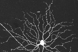 This image, taken with a light microscope, shows the body and many branching dendrites of a retinal ganglion cell.