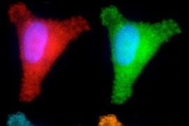 MIT biological engineers have developed a way to test several different DNA repair pathways in one cell. In each of these images, the cell is producing a different colored fluorescent protein, indicating whether it has successfully repaired one of four different types of DNA damage.