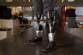 Herr wears two BiOM T2 prostheses