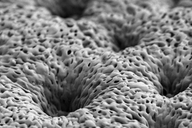 Pictured is a scanning electron micrograph of a porous, nanostructured poly(lactic-co-glycolic acid) (PLGA) membrane. The membrane is coated with a polyelectrolyte (PEM) multilayer coating that releases growth factors to promote bone repair.