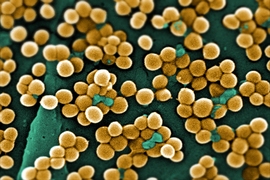 A scanning electron micrograph depicts numerous clumps of methicillin-resistant Staphylococcus aureus bacteria, commonly referred to by the acronym MRSA.
