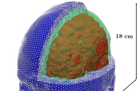 MIT researchers have developed a model of the human head for use in simulations to predict the risk for blast-induced traumatic brain injury. Relevant tissue structures include the skull (green), brain (red), and flesh (blue).