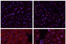 Aag deficient liver cells undergoing ischemia/reperfusion (bottom right) do not release as many inflammatory chemicals as normal cells (bottom left). The top row shows liver cells from mice that did not undergo ischemia/reperfusion.