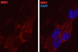 Musashi proteins, stained red, appear in the cell cytoplasm, outside the nucleus. At right, the cell nucleus is stained blue.