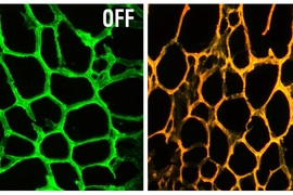 At left is the new nanodevice, consisting of a hydrogel embedded with gold nanoparticles coated with DNA targeting a gene called MRP-1. At right, the device fluoresces after encountering the target gene sequence.