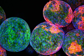 The sugar polymers that make up the spheres in this image are designed to package and protect specially engineered cells that work to produce drugs and fight disease. While on-site, they must remain undetected by the body’s natural defense system. However, the reddish markers on the spheres’ surfaces indicate that immune cells (blue/green) have discovered these invaders and begun to block them...