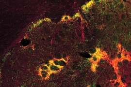 This image illustrates nerve fibers that originate in a part of the prefrontal cortex associated with emotion. The green shows the termination of fibers from a part of the prefrontal cortex in the striatum; the red depicts striosomes; and the yellow shows their overlap. The researchers found that the striatum — particularly the striosomes — may act as a gatekeeper that processes sensory and em...