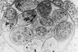 Toxoplasma gondii visible within a pseudocyst. 