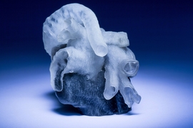 New system from MIT and Boston Children’s Hospital researchers converts MRI scans into 3D-printed heart models (shown here). 