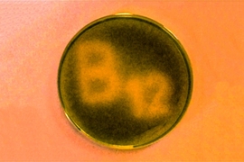 Color-corrected photograph of bacteria "spelling" B12, when the vitamin-B12-dependent photoreceptor protein, CarH, senses light. 