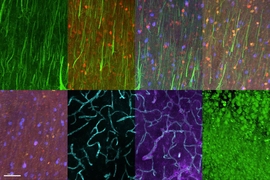 Labeling different proteins in a single tissue sample offers a new way to classify neurons and other cells. On the top row, pyramidal neurons are shown in green, and different types of inhibitory interneurons are labeled red, blue, and orange. In the bottom row, at far left, interneurons only are labeled. The two middle images show blood vessels in cyan, and astrocytes in purple. At far right, eve...
