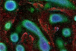 This image demonstrates tissue patterns that emerge from genetically programmed human pluripotent stem cells, and was taken on day nine of the MIT study. It shows immunostainings of cell nuclei for CEBPA (red, endodermal marker), SOX10 (green, ectodermal marker), and DAPI (blue, binds to DNA in the nucleus). 
