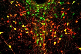 In this image of the dorsal raphe nucleus, dopamine neurons are labeled in green, red, or both (appearing yellow).
