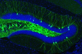 In this image of the hippocampal dentate gyrus of a mouse model of early Alzheimer’s disease, engram cells (green) that encode a fear memory were tagged with the light-sensitive protein channelrhodopsin-2.
