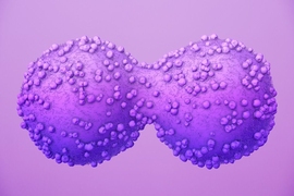 Artist interpretation of a cancer cell dividing