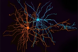 Two neurons of the basolateral amygdala. MIT neuroscientists have found that these neurons play a key role in separating information about positive and negative experiences.
