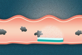 Researchers have created a new type of dual-sided pill that attaches to the gastrointestinal tract. One side of the pill sticks to mucosal surfaces, while the other is omniphobic, meaning that it repels everything it encounters.
