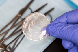 Researchers engineered a flexible polymer film that is made from a polymer called PLGA. The film can be rolled into a narrow tube and inserted through a catheter. Once the film reaches the pancreas, it unfolds and conforms to the shape of the tumor. 