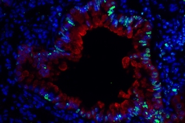 An image of epithelial cells surrounding a lung bronchiole in mice with asthma induced by dust mites. Researchers have shown that this type of asthma also produces DNA damage in lung cells, which is indicated in green.
