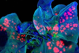 A new report, “Convergence: The Future of Health,” draws on insights from scientists and researchers across academia, industry, and government. The cover of the report is an image of lungs, one of the major sites of metastasis. To help protect the lungs (blue) from this deadly process, bioengineers have created microscopic drug depots (red) to focus the effect of anti-cancer drugs that may hav...