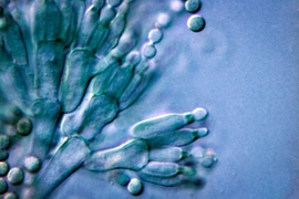 A research team led by MIT chemistry professor Mohammad Movassaghi has developed a strategy for synthesizing a group of compounds called communesins, which occur naturally in some fungi. Researchers may now be able to further investigate the compounds’ cancer-fighting abilities. Pictured is an image of penicillium fungus.