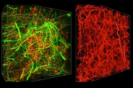 A new technique called magnified analysis of proteome (MAP), developed at MIT, allows researchers to peer at molecules within cells or take a wider view of the long-range connections between neurons.

