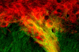 MIT neuroscientists have identified tight connections between dopamine-producing cells of the substantia nigra (red) and neurons in the striatum (green). These connections, which show up as yellow, may play a role in the brain’s decision-making processes.
