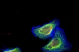 This image shows triple-negative breast cancer cells with high levels of “Mena invasive” protein and treated with Paclitaxel. The cell cytoskeleton is shown in blue, the dynamic microtubules are shown in green, and the stable microtubules are shown in red. 
